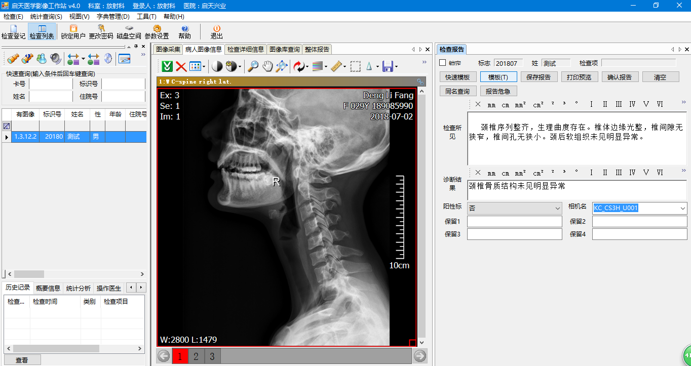 放射科颈椎.png